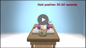 Learn How To Perform The Epley Maneuver To Treat Benign Paroxysmal Positional Vertigo Bppv Epley Maneuver Vertigo Healing