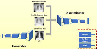 Semi Supervised Learning With Generative Adversarial Networks For Chest X Ray Classification With Ability Of Data Domain Adaptation Semantic Scholar