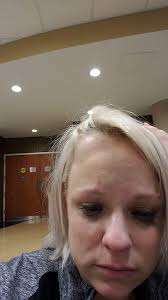 concussion from slipping