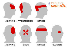 Cefalea Principali Cause E I Rimedi Pratici Fisioterapia Osteopatia A Roma Eur Physiocast One