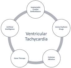 Image result for Ventricular Fibrillation Management in the Adult