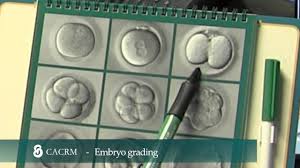 understanding embryo grading blastocyst grades