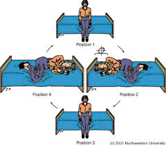 Home Treatment Of Bppv