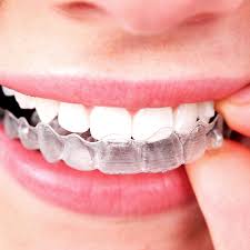 Regardless of which type of retainer you get, you'll want to make sure you know how to properly care for it. Cleaning Your Retainers Braces4u Mackay Orthodontist