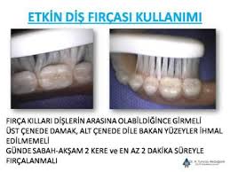 Dis Eti Kanamasi Neden Olur Nasil Tedavi Edilir Dr Tuncay Akdoganli