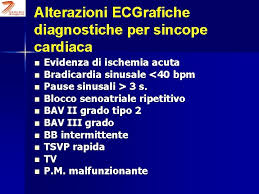 Síncope (vasovagal, ortostático y cardíaco). Gestione Della Sincope Nel Dipartimento Di Urgenza Giuseppa