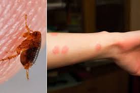 Image result for flea bite