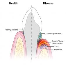 Researchers Identify Immune Culprits Linked To Inflammation