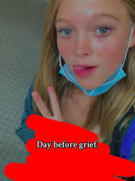 Mason Bone Car Accident