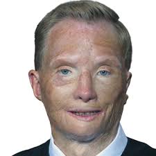 98131 Seattle Top 10 Accident And Injury Attorneys