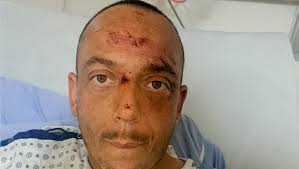 Alberta tow truck driver struck by vehicle, flown to hospital by STARS