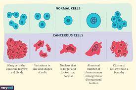 This mutation would be a marker of rectal cancer, and not colon cancer. Cancer Cells Vs Normal Cells How Are They Different