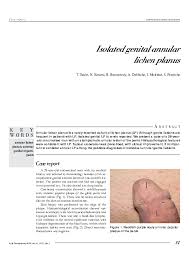Print patient handout images (266). Pdf Isolated Genital Annular Lichen Planus S Fenniche And N Kenani Academia Edu