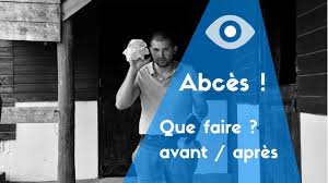 Tuto 3 Comment Soigner Une Infection Profonde De La Fourchette Youtube
