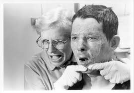 Barbara Knothe Burn Therapist Achievement Award