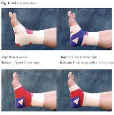 How to put on your medical walking boot for a sprained ankle or broken foot. Why Tape My Ankle Hughston Clinic