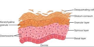 In this case, accumulation of the desquamated epidermis and cerumen occurs, what can lead to the formation of cholesteatoma. The 5 Layers Of Your Skin Dr Leslie Baumann