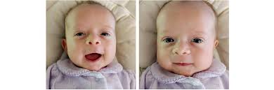 UK begins Pediatric Heart Surgery Program with Cincy Children's