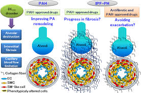 Image result for Diffusing Capacity