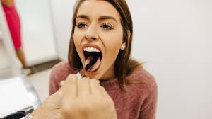 Pharmacy First Toolkit: Sore throat