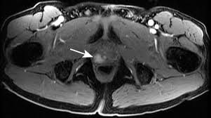 Check spelling or type a new query. Module 5 Pelvis Imaging