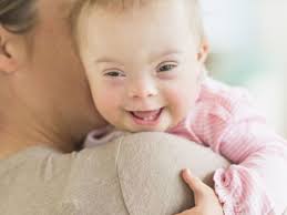 Aborting fetuses with Down syndrome should be legal. But it's straight up  wrong.