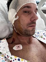 Exostosis/Surfer's Ear and Kayakers