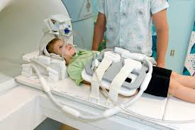 نتیجه تصویری برای MRI   سر