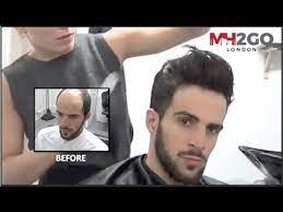 Hippie, grunge, jesus style wig. Hair Replacement Fitting Video Hair Loss Baldness Hair Wigs Hair Toupees Hair Pieces Youtube