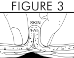 The Ideal Way To Measure Body Fat How To Use Accu Measure