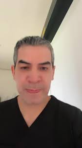 A 15 dias del tratqmiento de laser CO2 para tensado de piel en cara.  #tijuana #sandiego #laserco2 #tensadodepiel #mexicali