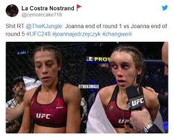 Former women's ufc champ shows off horribly discoloured face. Ufc Fighter Joanna Jedrzejczyk S Face Left Disfigured After Savage Defeat By Weili Zhang At Ufc 248 Premium News24