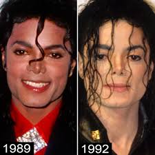 Check spelling or type a new query. Michael Jackson S Plastic Surgery See His Transformation