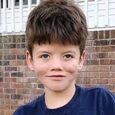 The moebius syndrome foundation's mission is to provide information and support to individuals with moebius syndrome and their families, promote greater awareness and. Young Boy With Moebius Syndrome Smiles For The First Time After Facial Reanimation Surgery Youtube