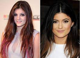 Before the procedure her lips were thin and that did not make her face look good. Kylie Jenner Before And After Photos 2008 To 2021