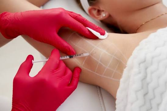 Best Clinic for Botox for Sweating in Dubai