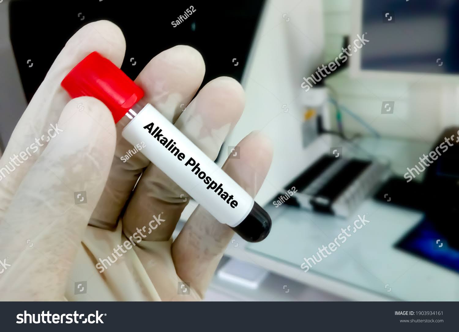ALKALINE PHOSPATE product image