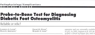 Image result for Probe-to-Bone Test