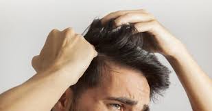 Come Trattare Le Patologie Dei Capelli Risponde Ide A Milano