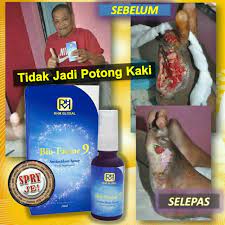 Gylcostat® (peria katak hutan) telah diuji secara klinikal ke atas pesakit kencing manis. Spray Bio Factor 9 Elak Kaki Dipotong Ubat Kencing Manis Diabetis Shopee Malaysia