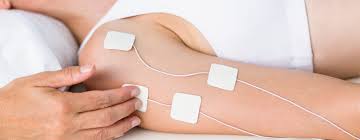 Image result for Electrical Stimulation Therapy