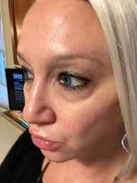 Does anyone have Lipoma pompons available?