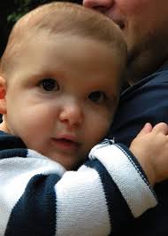 The disorder is characterized by a number of health defects including hirschsprung's disease, mental retardation, seizure disorder, delayed growth and motor development. Logan Mowat Wilson Syndrome Foundation