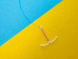 the iud other alternatives to the pill