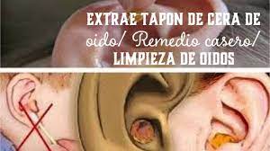 Elimina Tapon De Cera En Oidos Limpieza De Orejas Con Agua Oxigenada Para Curar Heridas Youtube