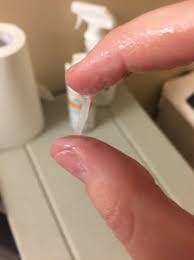 Egg White Mucus On Cycle Day 7 Babycenter