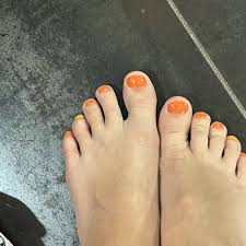 Image result for Clubbing nails feet