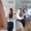 Hair loss occurs for many reasons; 1