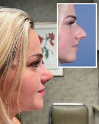 Dr Spencer Cochran (@dallas_rhinoplasty_center) • Instagram photos and  videos