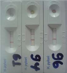 Photograph Of Sd Bioline H Pylori Rapid Antibody Test Results Left Download Scientific Diagram